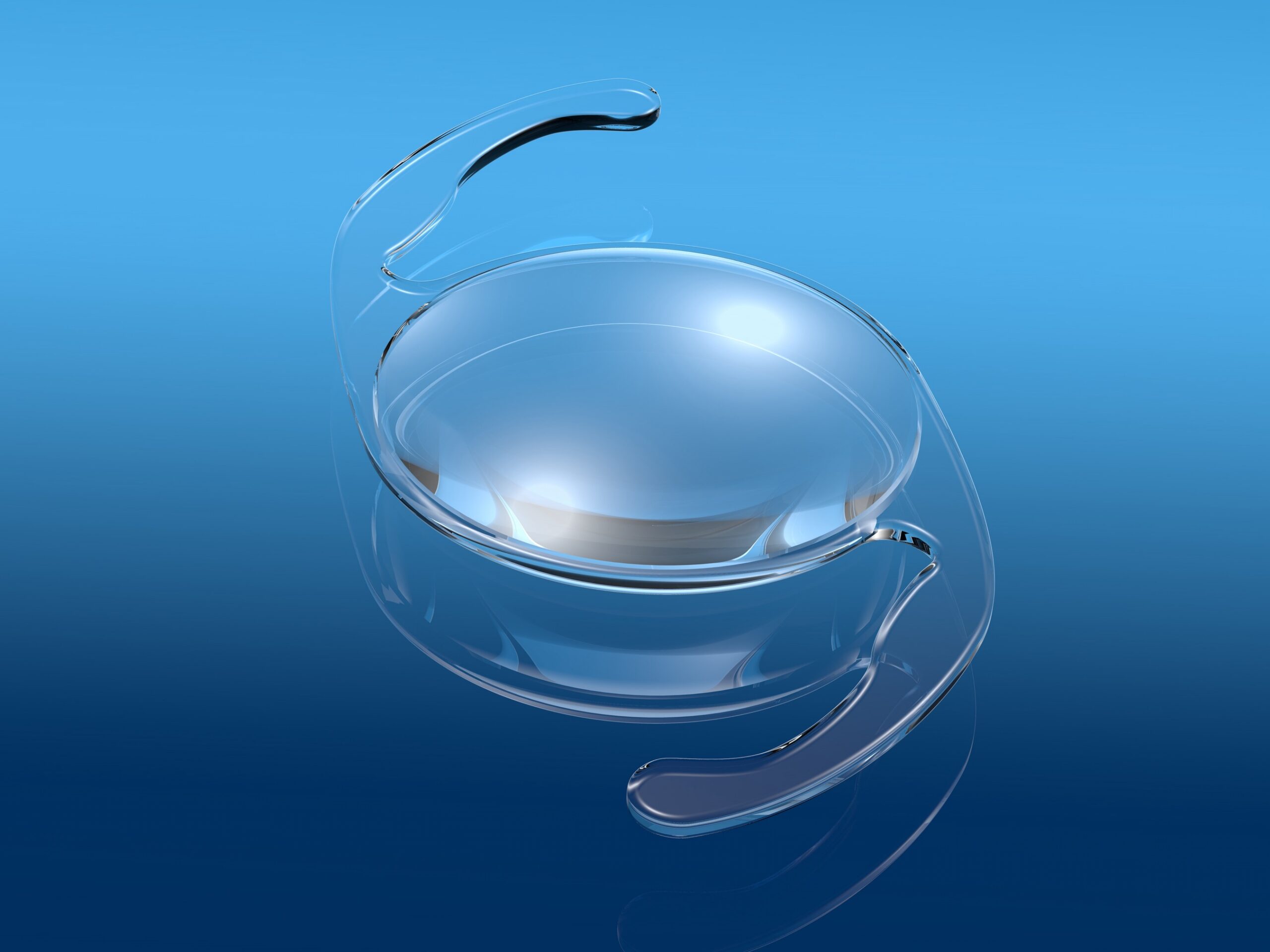 Medically illustration showing intraocular lens (IOL)
